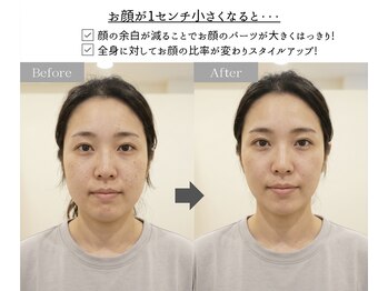 アジール 新潟市(agir)/1cmのサイズダウンで正面の変化