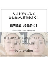 サロン ド ブラン アオヤマ(Salon de BLANC AOYAMA)/BIOPHYTO×韓国美容機器ソノケア