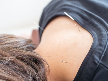 小嶋鍼灸治療院/