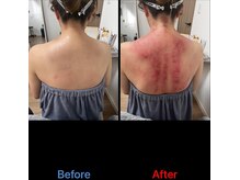 シュガーリングハウスレディ(SugaringHouse LADY)/かっさ