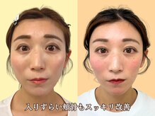 ナチュラルパーフェクトフェイス 新宿/小顔矯正/骨盤矯正/美脚矯正
