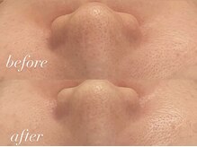 ミランサ ギンザ(MIRANSA GINZA)/【B/A】タラソフェイシャル