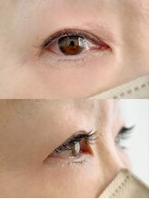 ムニ(muni)/LEDフラットラッシュ120本