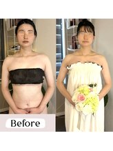 ソウ バイ ソウ(So by 蒼)/全身[調律]小顔矯正・1回の結果!