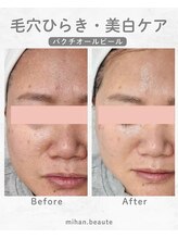 ミハン ボーテ(mihan.beaute)/