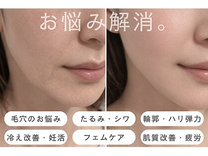 モアビューティー 紙屋町店の写真