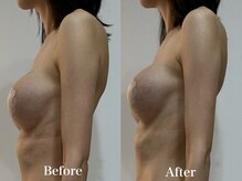 リュール(Lueur)/