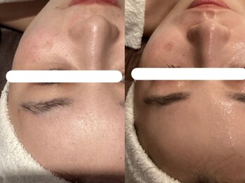 ジョーヌ(JAUNE)/ごわつき・ざらつきも一掃