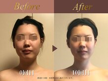 オーシャン(Ocean)/顔・体・足/週1回×10回
