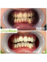 ルブラン 奈良店(Le Blanc)/駅近で通いやすい！