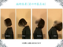 ボディ リセット アンド デザイン(Body Reset & Design)/【施術例】ビフォーアフター