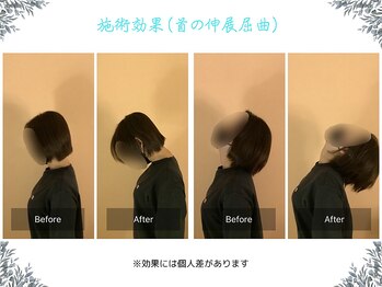 ボディ リセット アンド デザイン(Body Reset & Design)/【施術例】ビフォーアフター