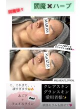 マリス(MARISS)/【西新井/ブライダル/小顔】