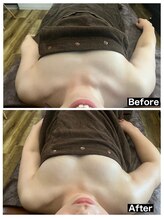 ハーズプラス(hers+)/バストアップコースでお椀型に！