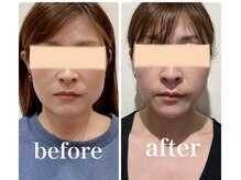 クリーム 京都店(Cream)/