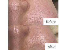 メイス 福井店(MEIS)/お客様Before、After