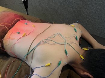 康泰苑鍼灸整体院の写真/【大塚駅徒歩2分】あらゆる不調に鍼灸という選択肢を！研鑽を積んだ鍼灸師が長年の悩みに向き合います！