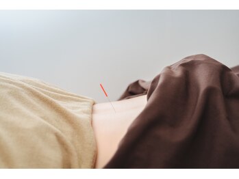 ミラー(mirror)/「お身体の鍼施術」