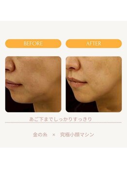 ムーンライズ(moonrise)/