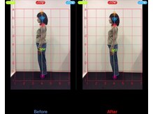 ケアルーム 綱島(CARE room)/施術効果写真☆（before after）