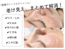 ビタザボナ(Vita the Bona)