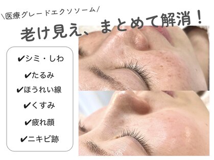 ビタザボナ(Vita the Bona)の写真