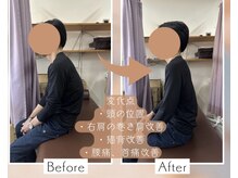 松山ひがし接骨院