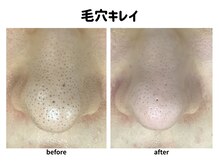 パールプラス 日田店/毛穴キレイ