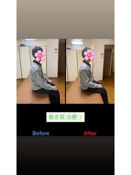 ヴィバランス(Vebalance)/巻き肩施術の効果♪
