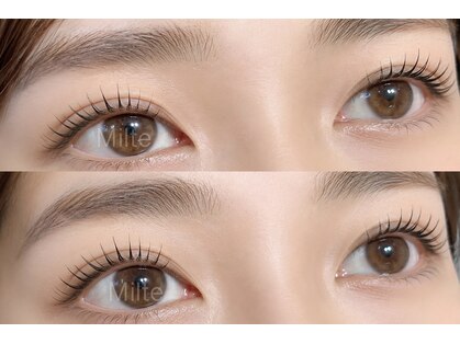 ミルト(Milte)の写真