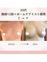 ミミバスト(mimibust)/バストアップBeforeAfter