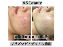 アンドエスビューティ(&S Beauty)の雰囲気（ニキビケア/赤み肌/肌あれに◎美肌目指す方にもオススメ◎）