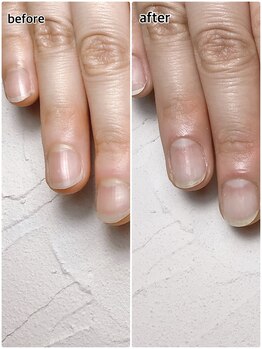 ピンクの部分の伸びます