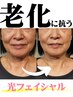 【フェイシャル】大人肌の悩みはありますか？狙うのは奥深い真皮のケア！