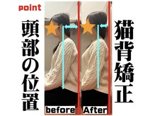 もりわき骨盤鍼灸整骨院 堺筋本町の雰囲気（猫背矯正後の姿勢の変化！◎ 肩こり/腰痛/頭痛/巻き肩/スマホ首）