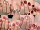 リライトネイル(Relight nail)の写真