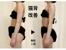 ディアメデル(Diamedel)/