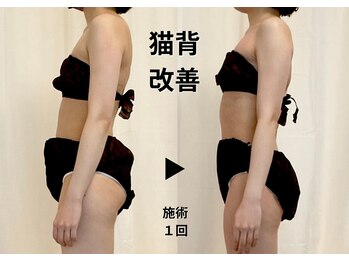 ディアメデル(Diamedel)/