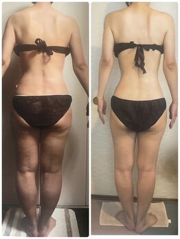 ロズアスール/★お客様の効果写真★