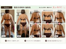 リノリー(rinory)の雰囲気（脂肪冷却痩身×キャビ×ハンド）