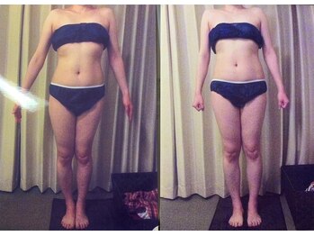 パーフェクトボディプレミアム 神戸三宮店(PERFECT BODY PREMIUM)/お客様 ビフォーアフター(11)