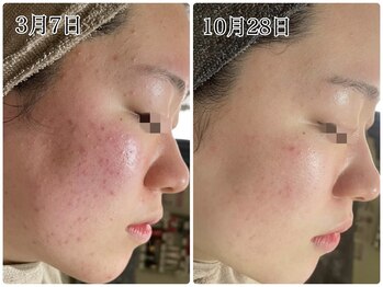 アイルーム(i.room)/