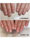 自爪育成　ビフォーアフター