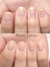マリーロール 淀屋橋本店(Marie Laure)/自爪育成/深爪矯正/ネイルケア