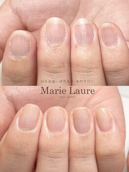 マリーロール 淀屋橋本店(Marie Laure)/自爪育成/深爪矯正/ネイルケア