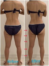 スペチアーレ 夙川/浮腫みが取れて脚長に