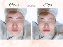 ソワナ(soina)の雰囲気（お悩みに合わせて使用する＜ピーリング商材＞で肌質改善！）