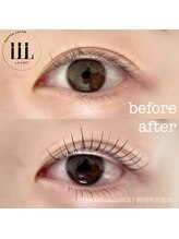 ロイ(ROI)/まつげパーマ　ビフォーアフター