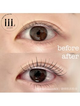 ロイ(ROI)/まつげパーマ ビフォーアフター