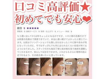 ホワイトアクア 天王寺本店(WHITE AQUA)/ハーブピーリング/大阪/天王寺